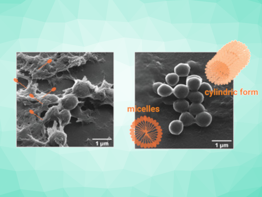 How Does Lipidation Affect the Activity of Antimicrobial Peptides?