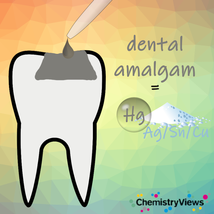 Dental Restoration Materials ChemistryViews