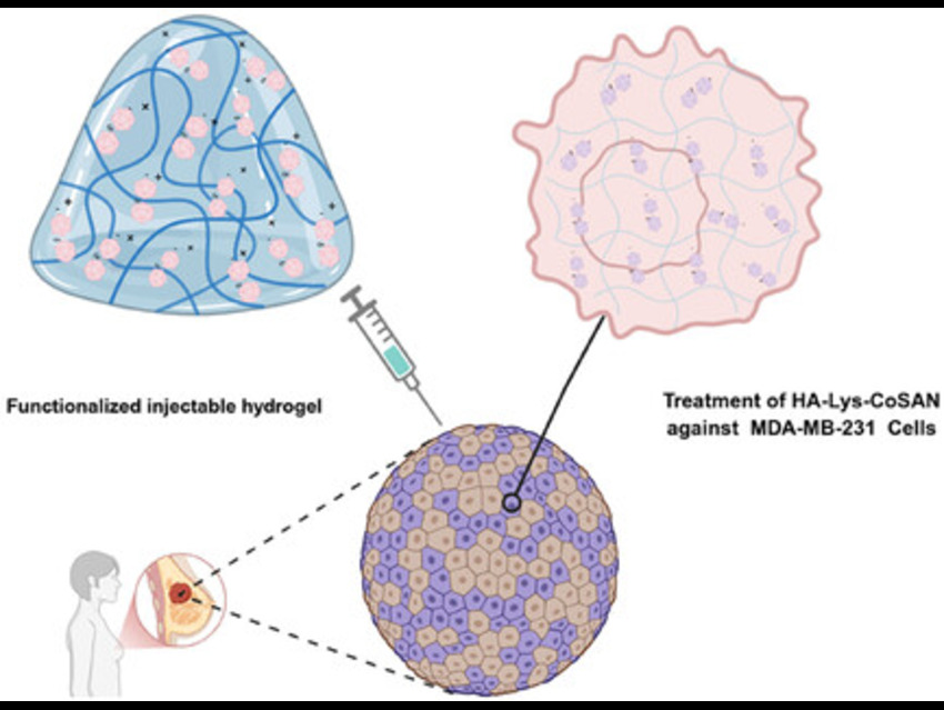 Smart Hydrogels Target Triple-Negative Breast Cancer