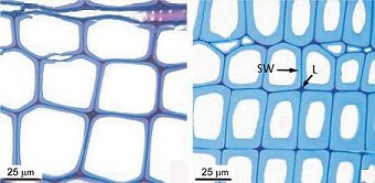 Cells for the transport of water in earlywood and latewood.