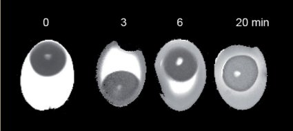 Nuclear tomograms of eggs boiled for various periods of time