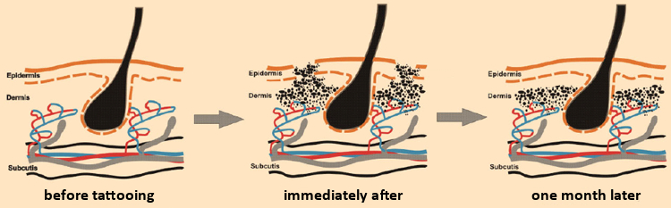 Skin structure and pigment layering