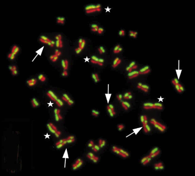 Sister chromatid exchange