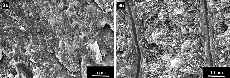 Enlarged enamel crystallite and dentin tubuli