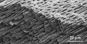 Sectional preparation of a human tooth, with parallel dentin tubuli