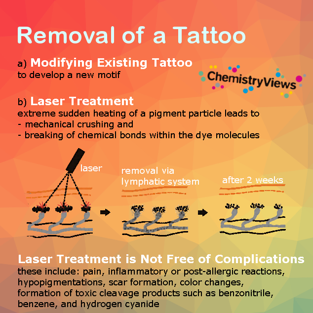 Removal of a tattoo
