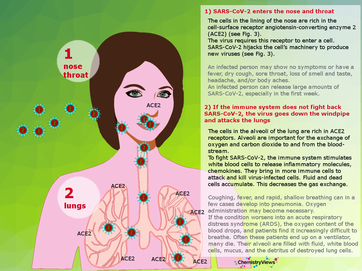 What coronavirus does to the body: COVID infection process, symptoms