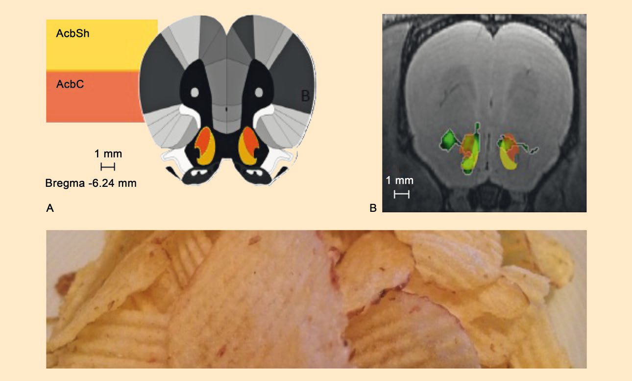 Brain acitivity