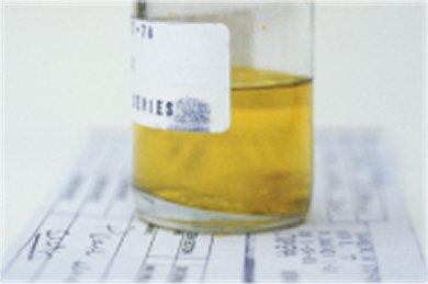 Fast-track Urine Testing