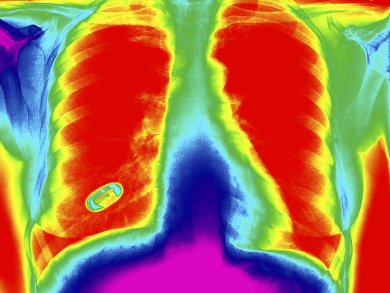 Ozone on the Lungs