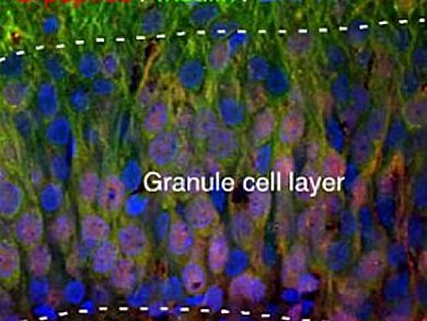 Neural Stem Cell Transplantation for Diabetes Treatment