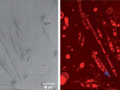 Real-time Bioprobe for Diabetes Treatments