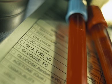 Blood Test for Alzheimer's