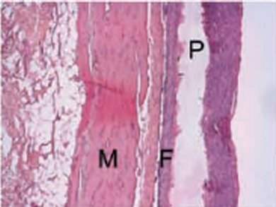 New Family of Elastomers for Tissue Engineering