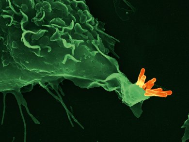 Biomarkers for Tuberculosis