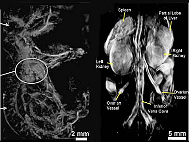 A Hot New Development: Photoacoustic Imaging