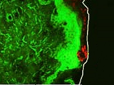 Safety of ZnO Nanoparticles in Sunscreen