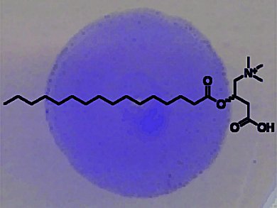 Fighting Biofilms