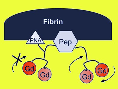 Targeted MR Contrast Agents