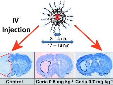 New Treatment for Stroke?