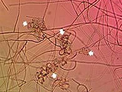 Multifunctional Nanoparticles from a Carnivorous Fungus