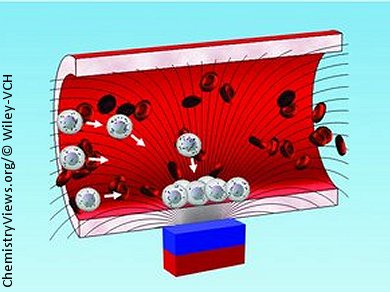 Iron Oxide Nanoparticles Show the Way