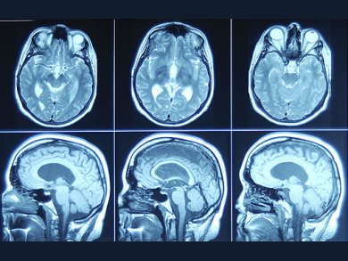 A Tumorigenic Breakdown