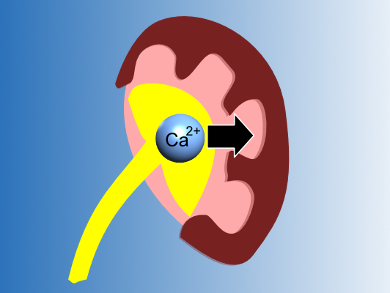 A Class of Anti-Leukemic Drugs Treats Kidney Stones