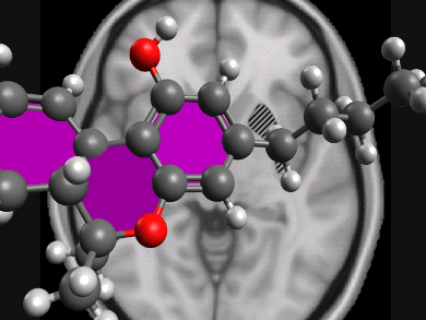 Does Cannabis Help with Alzheimer's Disease?