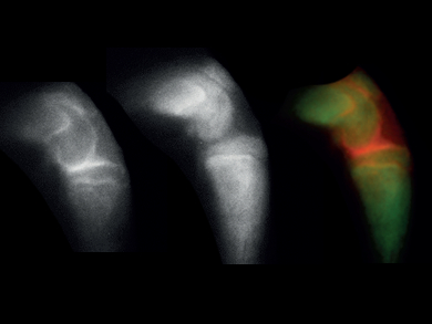 Contrast Agents for Imaging Cartilage