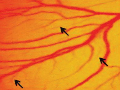 Graphene Oxide with Angiogenic Properties