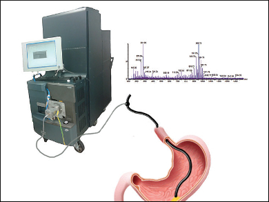 Endoscopic Cancer Detection in Real Time