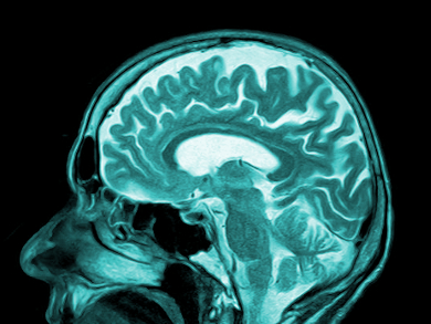 Encapsulation of Contrast Agents for MRI