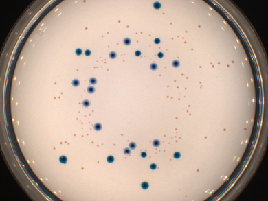 Pathogens on Microplastic Particles