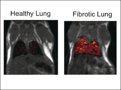 Monitoring Scar Tissue Formation