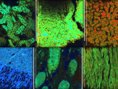 Fluorescent Probe for Hydrogen Peroxide Sensing