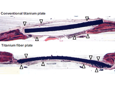 Titanium Fiber for Bone Tissue Repair