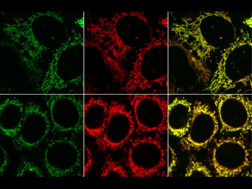 Better In Vitro Visualization of Biomolecules