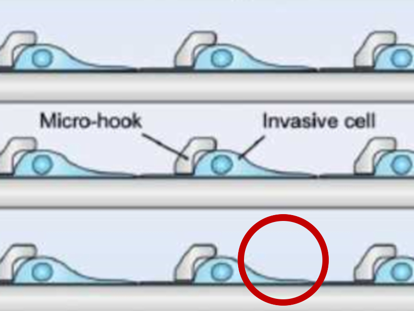 Analysis of Spreading of Cancer Cells