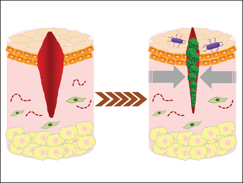Cerium Oxide Nanoparticles Promote Wound Healing