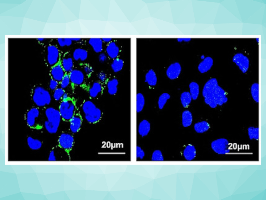 Platinum Complex Inhibits Cancer Metastasis