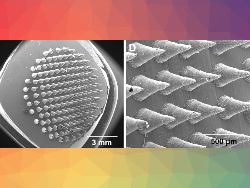 Biphasic Patches for Wound Healing