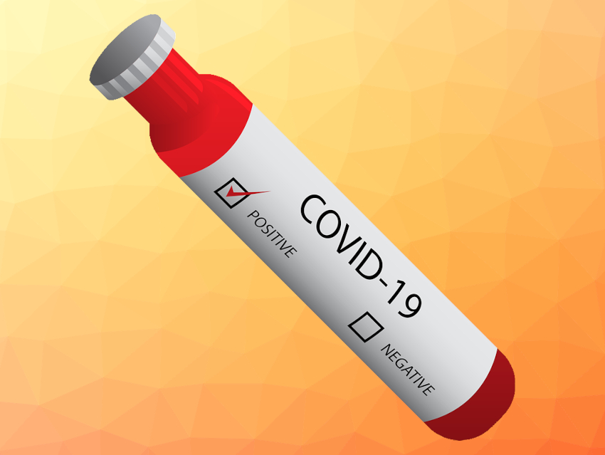 High-Throughput Test for COVID-19 Antibodies