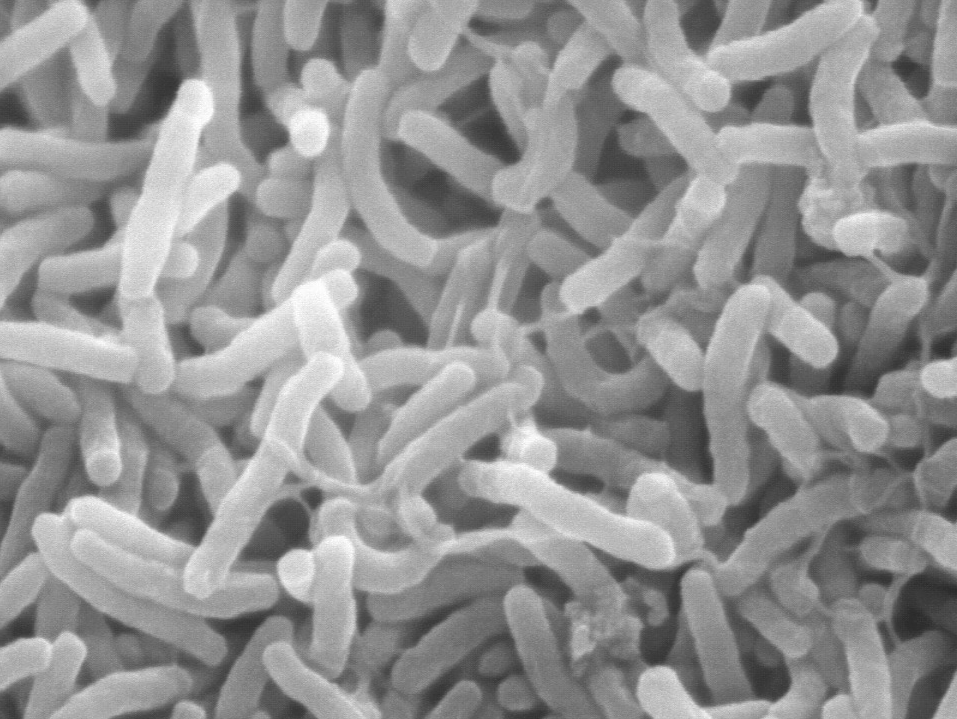 Polysaccharides Bound to Virus-like Particles for an Improved Cholera Vaccine
