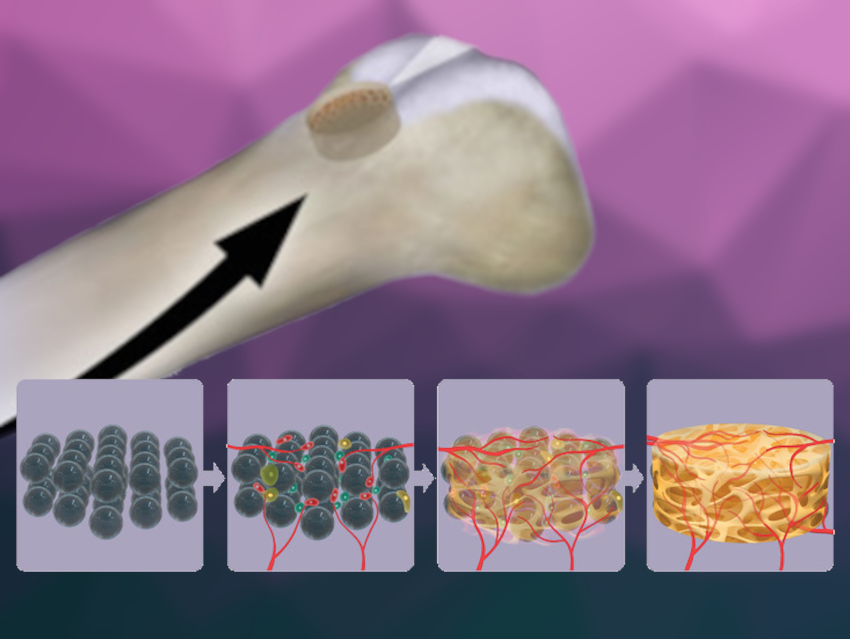 Gelatin Microsphere Aggregates Used as Scaffolds for Bone Regeneration